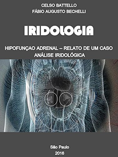 Livro PDF: Iridologia – Hipofunção Adrenal: Relato de um Caso – Análise Iridológica