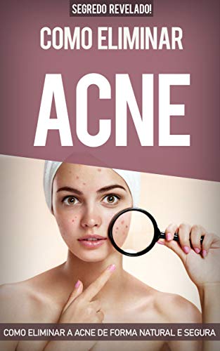 Livro PDF: Acne: Como Eliminar a Acne de forma natural e segura sem precisar de tratamentos caros, eliminando todas as espinhas e conseguindo uma pele saudável. Cure a acne em 31 dias ou menos.