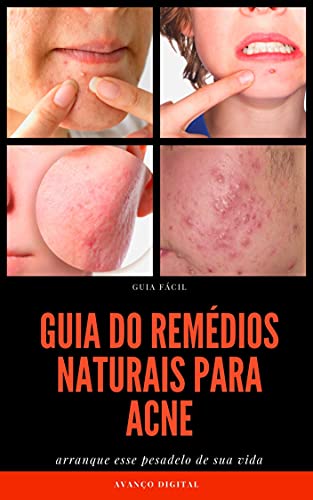 Livro PDF: Guia dos Remédios Naturais Para Acne CRAVOS E ESPINHA
